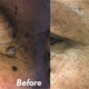 Remove Warts and Skin Tags Effortlessly